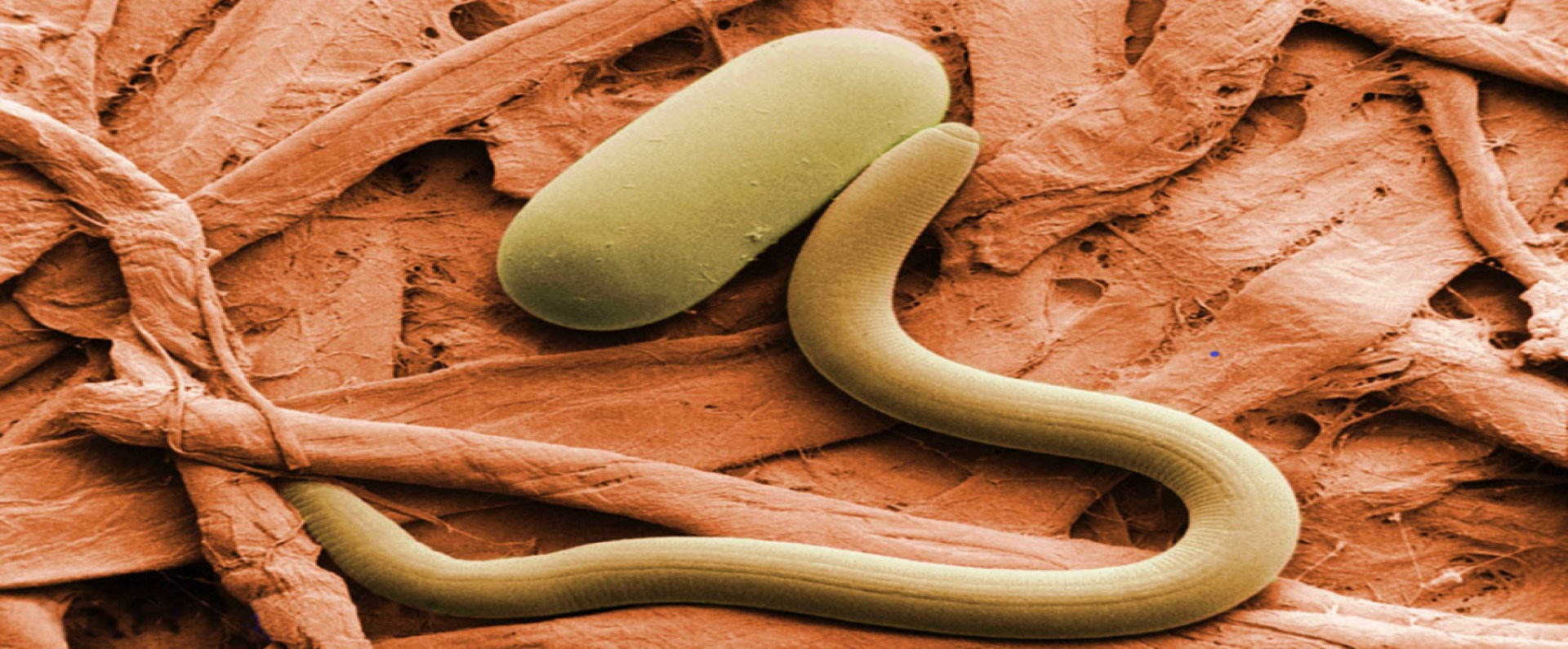 A soybean cyst nematode
