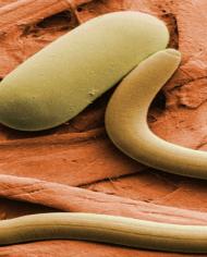 A soybean cyst nematode